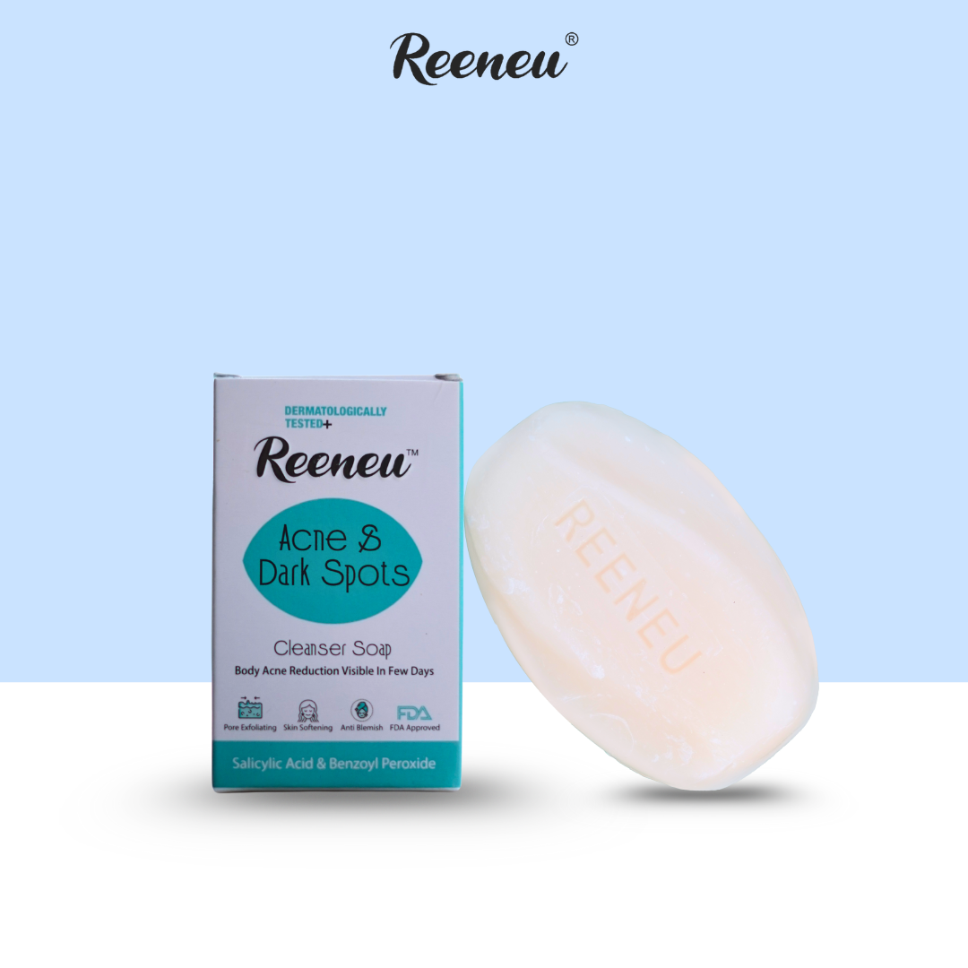 Body Acne Soap (Set of 3)