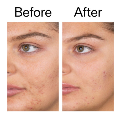 Gentle Facial Cleanser